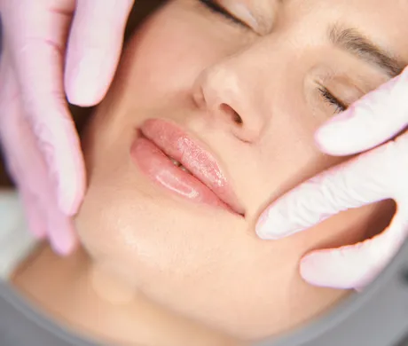 closeup of woman with fillers