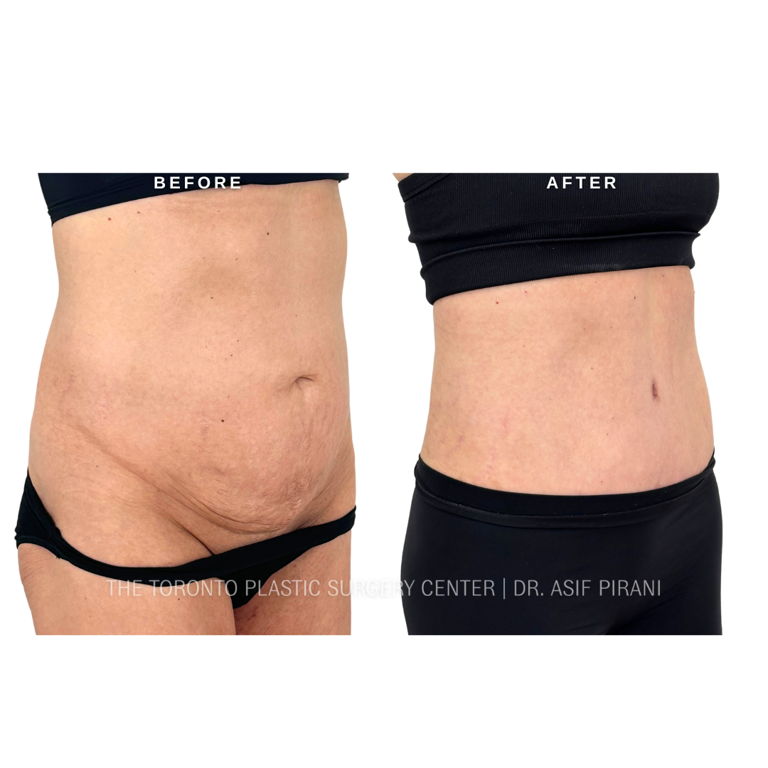 3 (15)